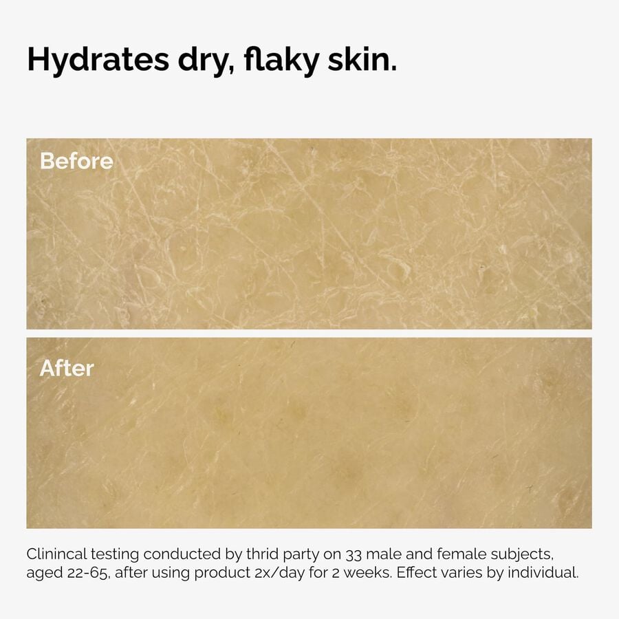 the-body-care-collection-h9 ord-natural-moisturizing-factors-inulin-body-before-after-graphic-02.jpg