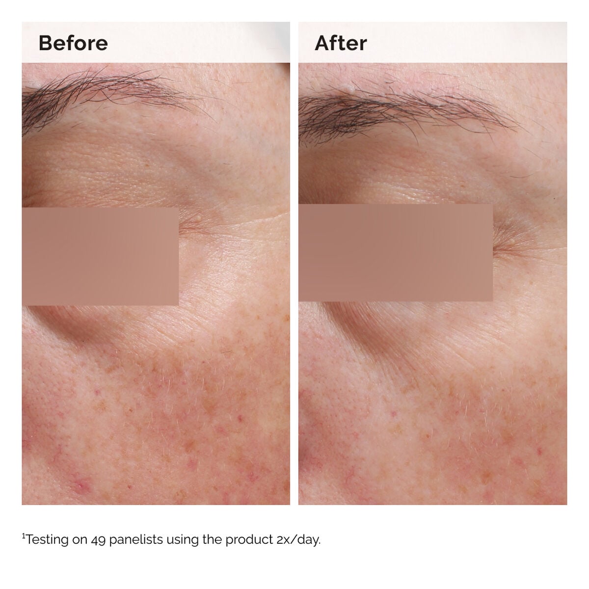niacinamide-5-face-and-body-emulsion-y6 2024-08-23-ORD-Nia-5pct-Face-Body-B-A-Elasticity-Global-02-1x1.jpg