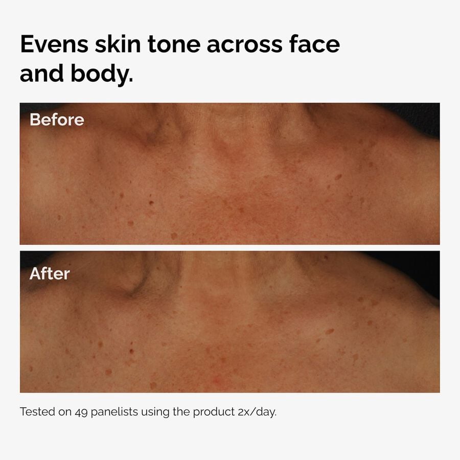 the-body-care-collection-h9 ord-niacinamide-face-body-serum-before-after-even-tone-graphic.jpg